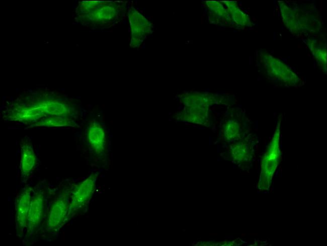 MSH4 Antibody in Immunocytochemistry (ICC/IF)