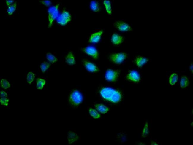 MTRF1 Antibody in Immunocytochemistry (ICC/IF)