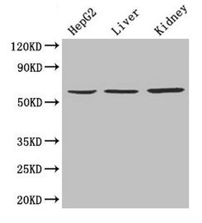 NAPRT1 Antibody in Western Blot (WB)