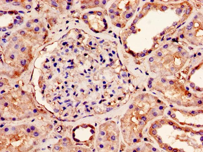 NDUFS4 Antibody in Immunohistochemistry (Paraffin) (IHC (P))