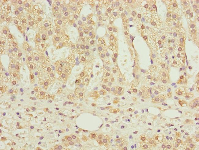 NDUFS6 Antibody in Immunohistochemistry (Paraffin) (IHC (P))