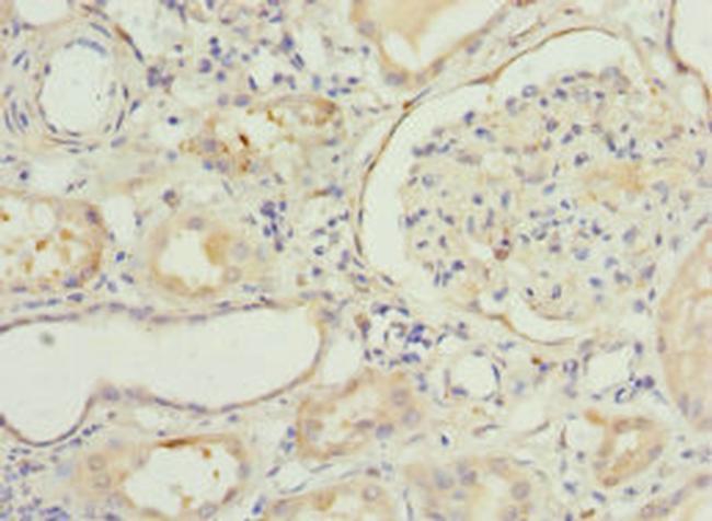 NNMT Antibody in Immunohistochemistry (Paraffin) (IHC (P))