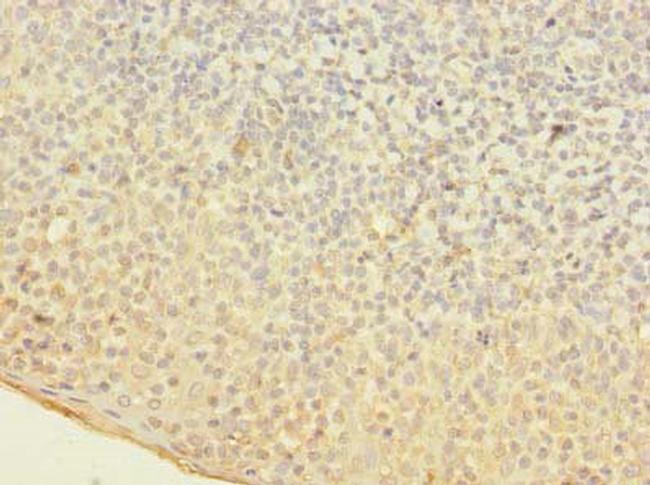 OGG1 Antibody in Immunohistochemistry (Paraffin) (IHC (P))