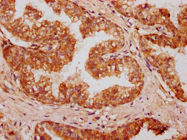 OMD Antibody in Immunohistochemistry (Paraffin) (IHC (P))