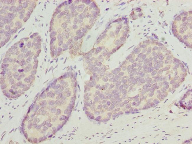 OPHN1 Antibody in Immunohistochemistry (Paraffin) (IHC (P))