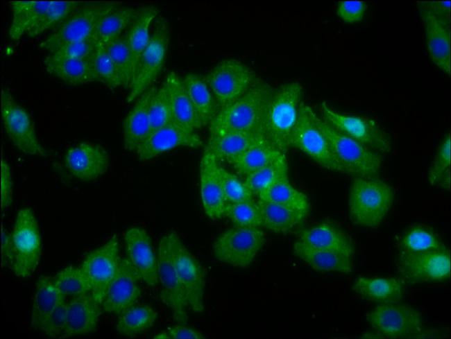 Opsin Green Antibody in Immunocytochemistry (ICC/IF)