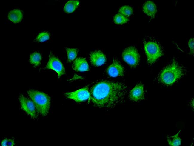 BUD31 Antibody in Immunocytochemistry (ICC/IF)