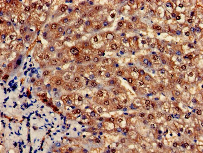 PCCA Antibody in Immunohistochemistry (Paraffin) (IHC (P))