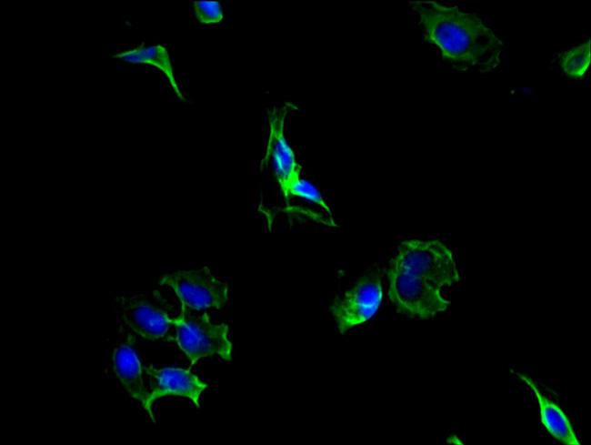 PCSK5 Antibody in Immunocytochemistry (ICC/IF)