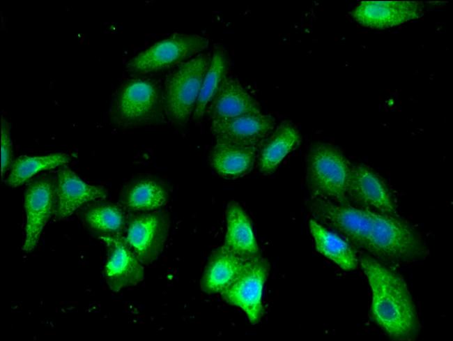 PDE2A Antibody in Immunocytochemistry (ICC/IF)