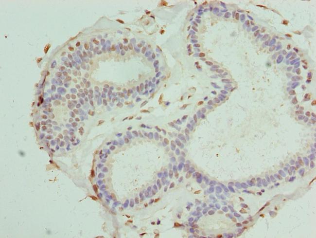 PDXK Antibody in Immunohistochemistry (Paraffin) (IHC (P))