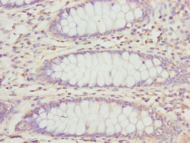 PECR Antibody in Immunohistochemistry (Paraffin) (IHC (P))