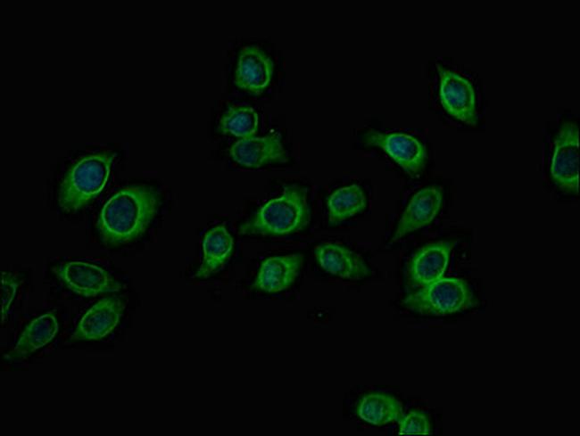 PFKM Antibody in Immunocytochemistry (ICC/IF)