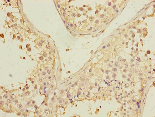 PGAM2 Antibody in Immunohistochemistry (Paraffin) (IHC (P))