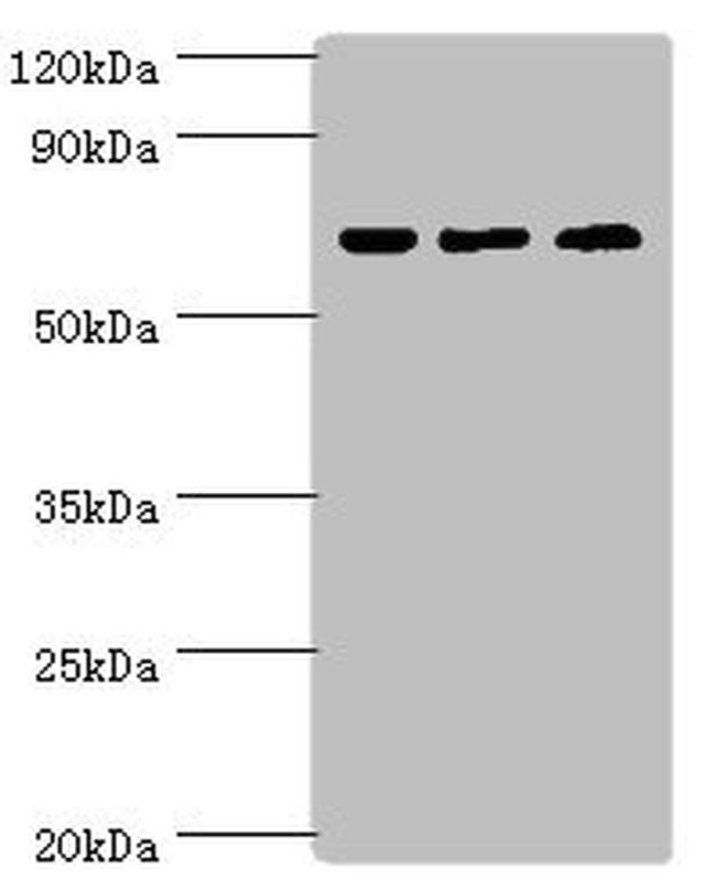 PIAS2 Antibody in Western Blot (WB)