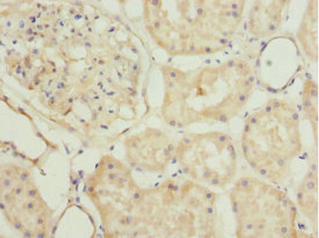 PLSCR1 Antibody in Immunohistochemistry (Paraffin) (IHC (P))