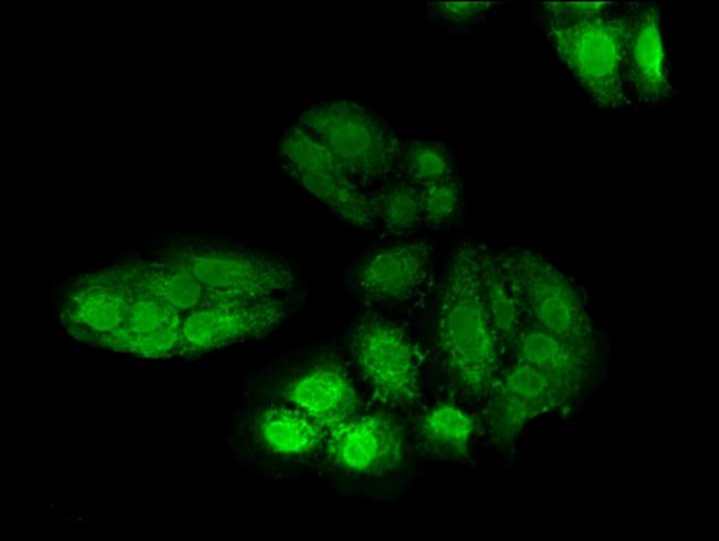 POLH Antibody in Immunocytochemistry (ICC/IF)