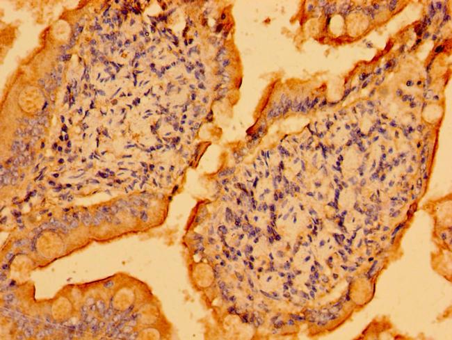 PSD Antibody in Immunohistochemistry (Paraffin) (IHC (P))