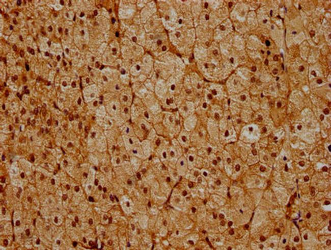 PSMC6 Antibody in Immunohistochemistry (Paraffin) (IHC (P))