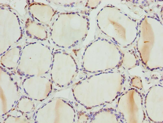 PSPH Antibody in Immunohistochemistry (Paraffin) (IHC (P))