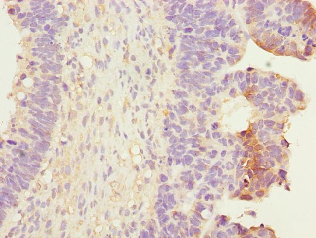 RALB Antibody in Immunohistochemistry (Paraffin) (IHC (P))