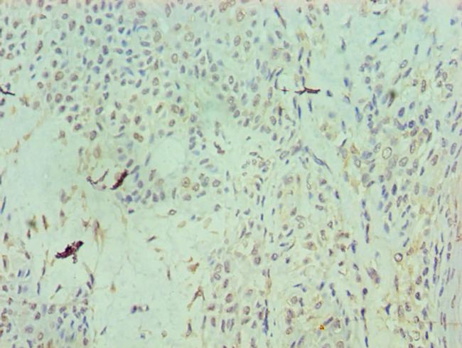 RAN Antibody in Immunohistochemistry (Paraffin) (IHC (P))