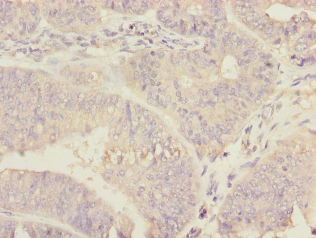 Ribophorin II Antibody in Immunohistochemistry (Paraffin) (IHC (P))