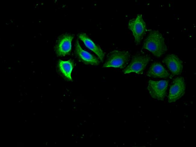 RPS15 Antibody in Immunocytochemistry (ICC/IF)