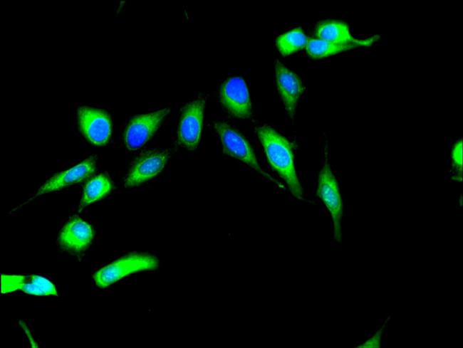 MSK2 Antibody in Immunocytochemistry (ICC/IF)