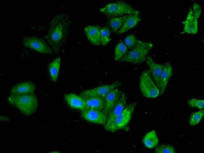 SnoN Antibody in Immunocytochemistry (ICC/IF)