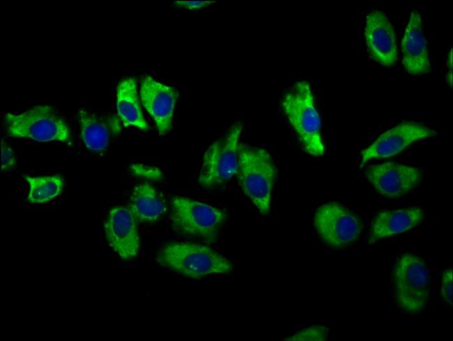 NKCC1 Antibody in Immunocytochemistry (ICC/IF)