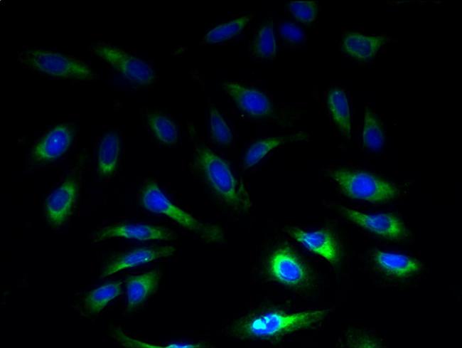 SLC1A6 Antibody in Immunocytochemistry (ICC/IF)