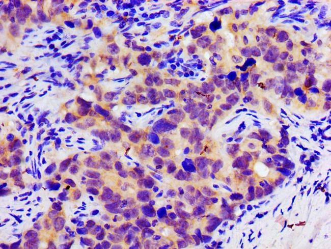 SLC25A12 Antibody in Immunohistochemistry (Paraffin) (IHC (P))