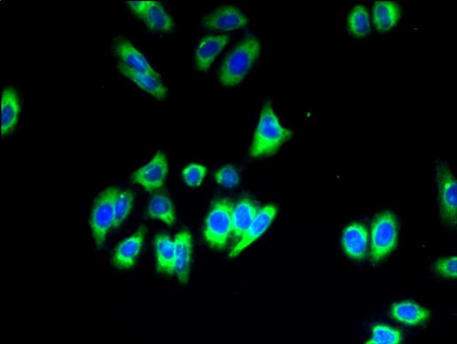 SLC35B1 Antibody in Immunocytochemistry (ICC/IF)