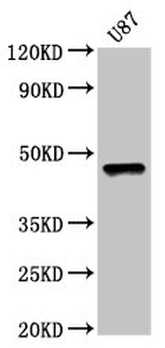 SOX8 Antibody in Western Blot (WB)