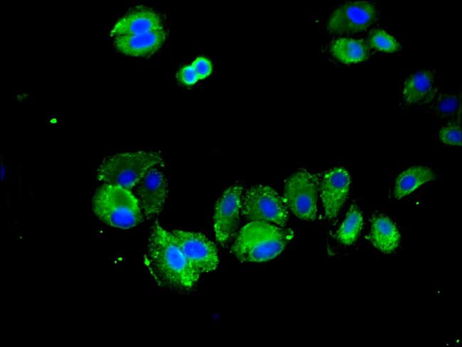 SPRY2 Antibody in Immunocytochemistry (ICC/IF)