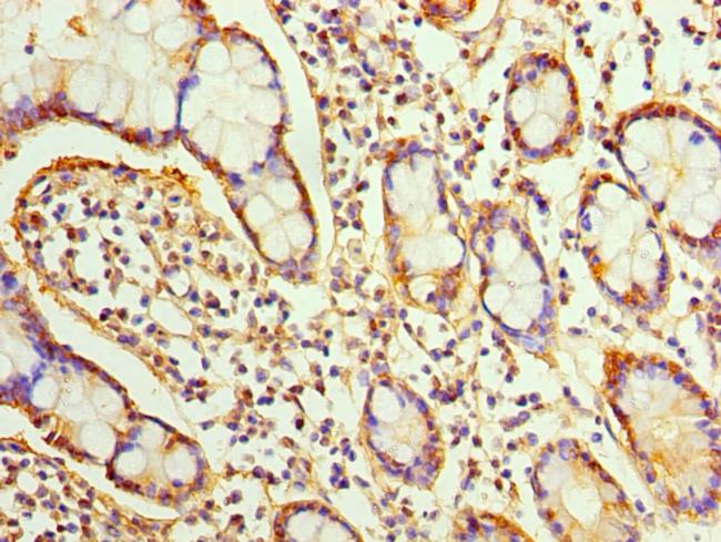 Sorcin Antibody in Immunohistochemistry (Paraffin) (IHC (P))