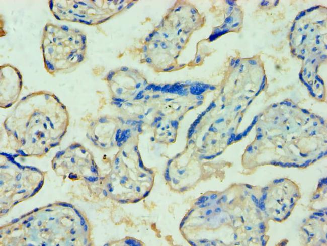 TDP1 Antibody in Immunohistochemistry (Paraffin) (IHC (P))