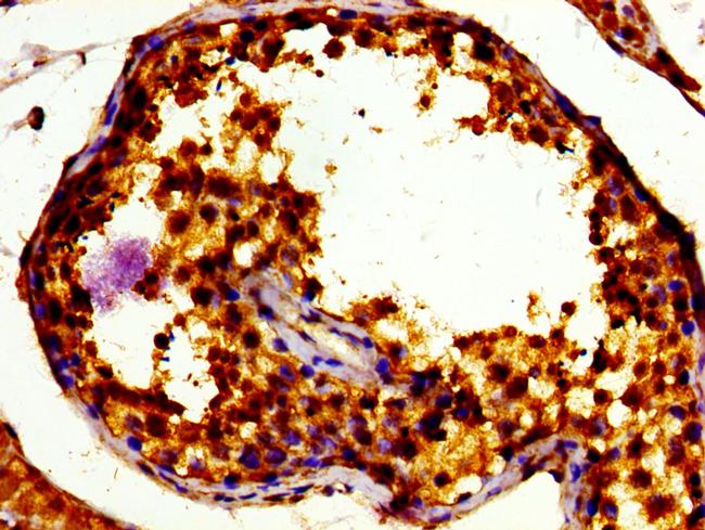 TFE3 Antibody in Immunohistochemistry (Paraffin) (IHC (P))