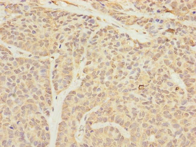 TIMM23 Antibody in Immunohistochemistry (Paraffin) (IHC (P))