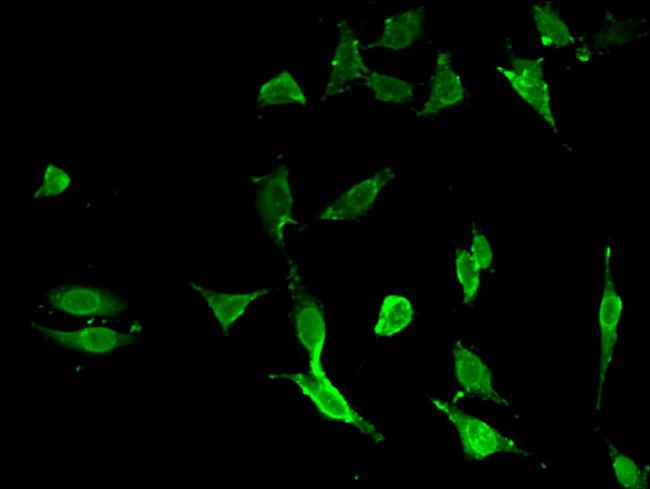 A20 Antibody in Immunocytochemistry (ICC/IF)