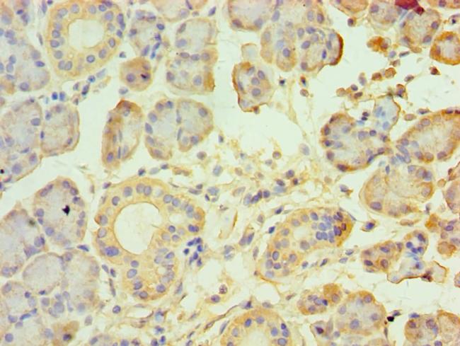 TRPM2 Antibody in Immunohistochemistry (Paraffin) (IHC (P))