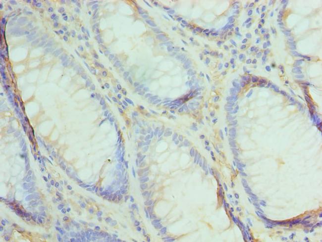 UBE2V2 Antibody in Immunohistochemistry (Paraffin) (IHC (P))