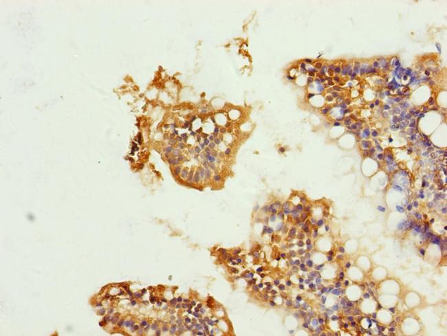 UQCRC1 Antibody in Immunohistochemistry (Paraffin) (IHC (P))