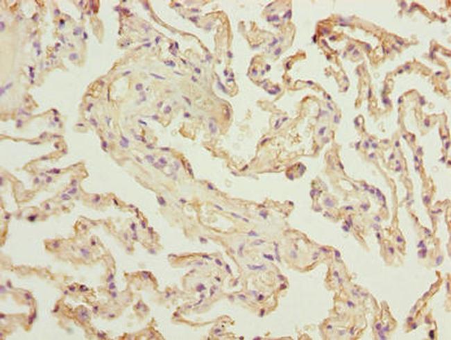 RAD23A Antibody in Immunohistochemistry (Paraffin) (IHC (P))