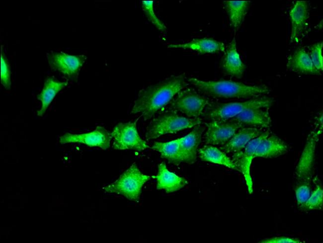 GSK3 alpha Antibody in Immunocytochemistry (ICC/IF)