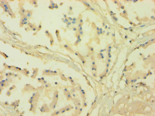 Cytochrome P450 Reductase Antibody in Immunohistochemistry (Paraffin) (IHC (P))