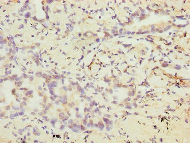 VEGFC Antibody in Immunohistochemistry (Paraffin) (IHC (P))