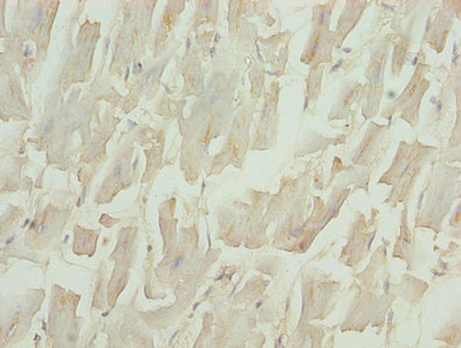 BNP Antibody in Immunohistochemistry (Paraffin) (IHC (P))