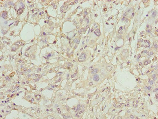 PLA2G7 Antibody in Immunohistochemistry (Paraffin) (IHC (P))